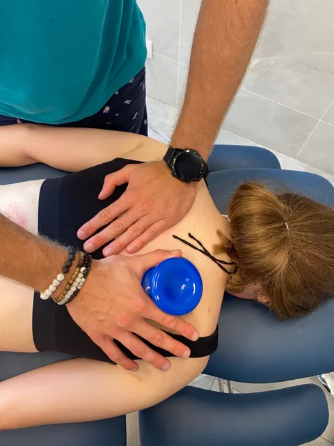 Bańka silikonowa stosowana na plecy pacjenta