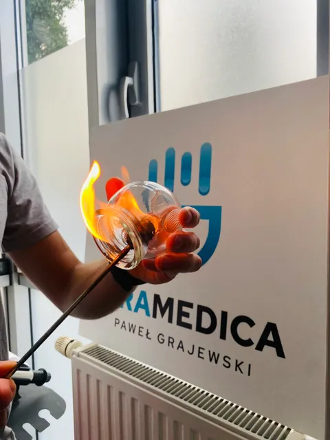 Przygotowanie baniek ogniowych w gabinecie GraMedica