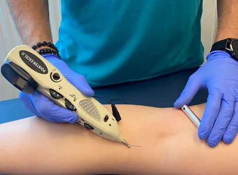 Urządzenie elektroakupunkturowe POINTER EXCEL II w użyciu